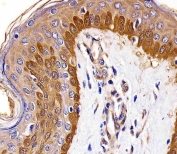 IHC testing of FFPE human skin tissue with S100A2 antibody. HIER: steam section in pH6 citrate buffer for 20 min and allow to cool prior to staining.