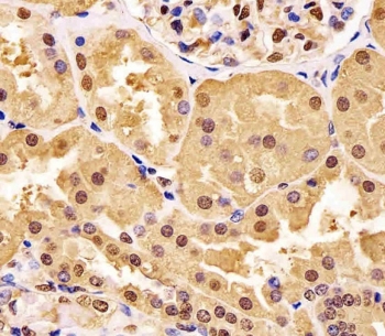 IHC testing of FFPE human kidney tissue with GAPDH antibody. HIER: steam section in pH6 citrate buffer for 20 min and allow to cool prior to staining.