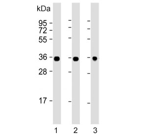 Western blot testing of human 1) HeLa, 2) Jurkat and 3) A549 cell lysate with GAPDH antibody. Predicted molecular weight ~36 kDa.