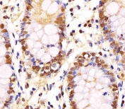 IHC testing of FFPE human colon tissue with GAPDH antibody. HIER: steam section in pH6 citrate buffer for 20 min and allow to cool prior to staining.