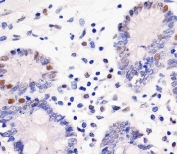 IHC testing of FFPE human colon tissue with GAPDH antibody. HIER: steam section in pH6 citrate buffer for 20 min and allow to cool prior to staining.