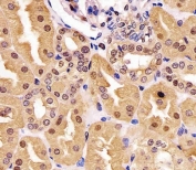 IHC testing of FFPE human kidney tissue with GAPDH antibody. HIER: steam section in pH6 citrate buffer for 20 min and allow to cool prior to staining.