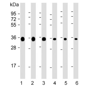 Western blot testing of 1) human HeLa, 2) human Jurkat, 3) human A549, 4) rat C6, 5) mouse NIH 3T3 and 6) mouse brain lysate with GAPDH antibody. Predicted molecular weight ~36 kDa.
