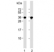 Western blot testing of human 1) HepG2 and 2) A431 cell lysate with PCNA antibody. Expected molecular weight: 29-36 kDa.