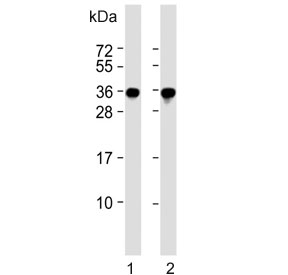 Western blot testing of human 1) HepG2 and 2) A431 cell lysate with PCNA antibody. Expected molecular weight: 29-36 kDa.