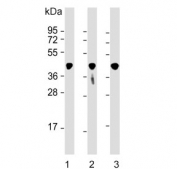 Western blot testing of 1) human HEK293, 2) human A431 and 3) mouse brain lysate with PGK1 antibody. Predicted molecular weight ~44 kDa.