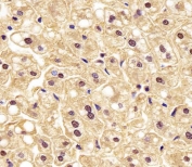 IHC testing of FFPE human liver tissue with PGK1 antibody. HIER: steam section in pH6 citrate buffer for 20 min and allow to cool prior to staining.