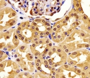 IHC testing of FFPE human kidney tissue with PGK1 antibody. HIER: steam section in pH6 citrate buffer for 20 min and allow to cool prior to staining.