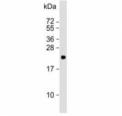 Western blot testing of rat cerebellum lysate with CD81 antibody. Predicted molecular weight: 22-26 kDa.