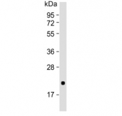 Western blot testing of human testis lysate with CD81 antibody. Predicted molecular weight: 22-26 kDa.