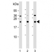 Western blot testing of human 1) A549, 2) Ramos and 3) U-87 MG cell lysate with CD81 antibody. Predicted molecular weight: 22-26 kDa.