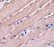 IHC testing of FFPE human skeletal muscle tissue with IRF7 antibody. HIER: steam section in pH6 citrate buffer for 20 min and allow to cool prior to staining.