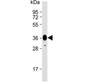 Western blot testing of recombinant human partial protein with Myosin 18B antibody.