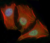 Immunofluorescent staining of fixed and permeabilized human HeLa cells with SMAD1 antibody (green), DAPI nuclear stain (blue) and anti-Actin (red).