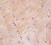 IHC testing of FFPE human skeletal muscle tissue with SMAD1 antibody. HIER: steam section in pH6 citrate buffer for 20 min and allow to cool prior to staining.