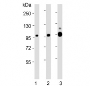 Western blot testing of human 1) placenta, 2) Ramos and 3) kidney lysate with CD10 antibody. Routinely visualized at ~100 kDa.