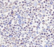 Immunocytochemical testing of PFA-fixed human 293T cells with B7-H3 antibody. HIER: pH9 EDTA.
