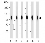 Western blot testing of human 1) 293T, 2) A431, 3) U-2 OS, 4) LNCaP, 5) HeLa and 6) MCF7 cell lysate with B7-H3 antibody. Expected molecular weight: 57-110 kDa depending on level of glycosylation.