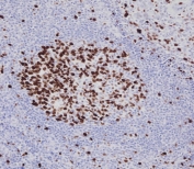 IHC testing of FFPE human tonsil tissue with Ki67 antibody. HIER: steam section in pH9 EDTA for 20 min and allow to cool prior to staining.