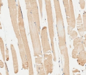 IHC testing of FFPE human skeletal muscle tissue with IRF7 antibody. HIER: steam section in pH6 citrate buffer for 20 min and allow to cool prior to staining.