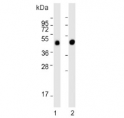 Western blot testing of 1) human liver and 2) rat liver lysate with METTL4 antibody. Predicted molecular weight ~54 kDa.