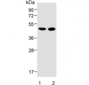 Western blot testing of human 1) liver and 2) U-2 OS lysate with METTL4 antibody. Predicted molecular weight ~54 kDa.
