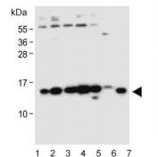 Western blot testing of human 1) HeLa, 2) MCF7, 3) HEK293, 4) Jurkat, 5) HL60, 6) mouse heart and 7) mouse NIH 3T3 lysate with SNRPD3 antibody. Predicted molecular weight ~14 kDa.