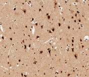 IHC testing of FFPE human brain tissue with SNRPD3 antibody. HIER: steam section in pH6 citrate buffer for 20 min and allow to cool prior to staining.