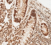 IHC testing of FFPE human colon tissue with SNRPD3 antibody. HIER: steam section in pH6 citrate buffer for 20 min and allow to cool prior to staining.