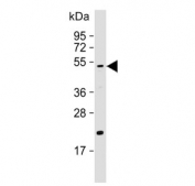 Western blot testing of mouse brain lysate with HTRA1 antibody. Predicted molecular weight ~51 kDa.