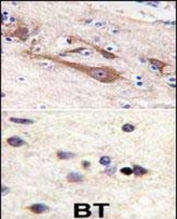 IHC testing of FFPE human brain tissue with (top) and without (bottom) Visinin-like protein 1 antibody. HIER: steam section in pH6 citrate buffer for 20 min and allow to cool prior to staining.