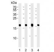 Western blot testing of 1) human SW480, 2) human brain, 3) mouse brain and 4) rat brain lysate with Visinin-like protein 1 antibody. Predicted molecular weight ~22 kDa.