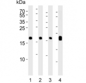 Western blot testing of 1) human brain, 2) mouse brain, 3) rat brain and 4) rat eyeball lysate with Visinin-like protein 1 antibody. Predicted molecular weight ~22 kDa.