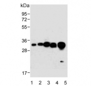 Western blot testing of 1) human NCI-H1299, 2) human HCT-116, 3) human PC-3, 4) mouse heart and 5) rat heart lysate with VDAC2 antibody. Predicted molecular weight: ~32 kDa.