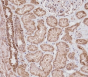 IHC testing of FFPE human kidney tissue with VDAC2 antibody. HIER: steam section in pH6 citrate buffer for 20 min and allow to cool prior to staining.