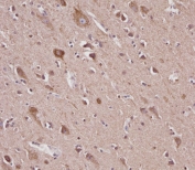 IHC testing of FFPE human brain tissue with VDAC2 antibody. HIER: steam section in pH6 citrate buffer for 20 min and allow to cool prior to staining.