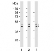 Western blot testing of human 1) HepG2, 2) LNCaP and 3) MDA-MB-453 cell lysate with UGT2B4 antibody. Predicted molecular weight: 43/46/61 kDa (three isoforms).