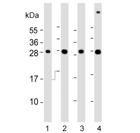 Western blot testing of 1) whole zebrafish, 2) zebrafish ZF4, 3) human heart and 4) mouse liver lysate with zebrafish ak2 antibody. Predicted molecular weight ~26 kDa.