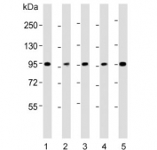 Western blot testing of human 1) HEK293, 2) A431, 3) HepG2, 4) Jurkat and 5) Raji cell lysate with SLC22A2 antibody. Expected molecular weight: 55-100 kDa depending on glycosylation level.