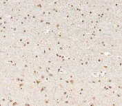IHC testing of FFPE human brain tissue with NUP93 antibody. HIER: steam section in pH6 citrate buffer for 20 min and allow to cool prior to staining.