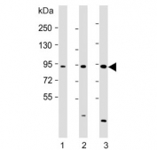 Western blot testing of 1) mouse F9, 2) human Jurkat and 3) human K562 lysate with NUP93 antibody. Predicted molecular weight ~93 kDa.