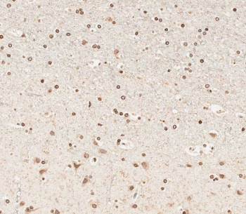 IHC testing of FFPE human brain tissue with NUP93 antibody. HIER: steam section in pH6 citrate buffer for 20 min and allow to cool prior to staining.