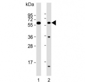 Western blot testing of human 1) skeletal muscle and 2) HeLa lysate with SLC29A2 antibody. Predicted molecular weight ~50 kDa.