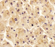 IHC testing of FFPE human liver tissue with SLC29A2 antibody. HIER: steam section in pH6 citrate buffer for 20 min and allow to cool prior to staining.