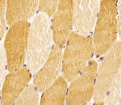 IHC testing of FFPE human skeletal muscle tissue with SLC29A2 antibody. HIER: steam section in pH6 citrate buffer for 20 min and allow to cool prior to staining.
