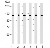 Western blot testing of 1) human skeletal muscle, 2) human A431, 3) human HeLa, 4) mouse kidney, 5) rat PC-12 and 6) human HepG2 cell lysate with Vinculin antibody. Predicted molecular weight ~124 kDa.
