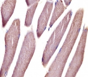 IHC testing of FFPE mouse skeletal muscle tissue with Vinculin antibody. HIER: steam section in pH6 citrate buffer for 20 min and allow to cool prior to staining.