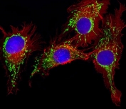 Immunofluorescent staining of fixed and permeabilized human HepG2 cells with 60 kDa Heat Shock Protein antibody (green), DAPI nuclear stain (blue) and anti-Actin (red).