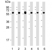 Western blot testing of human 1) Jurkat, 2) HeLa, 3) HepG2, 4) MCF7, 5) mouse NIH 3T3 and 6) rat PC-12 cell lysate with 60 kDa Heat Shock Protein antibody. Predicted molecular weight ~60 kDa.