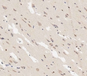 IHC testing of FFPE human brain tissue with MAP1LC3A antibody. HIER: steam section in pH6 citrate buffer for 20 min and allow to cool prior to staining.